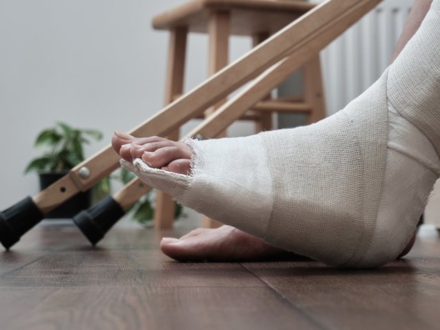 كسور العظام